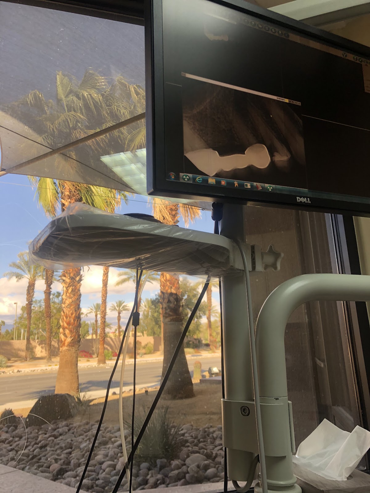 Palm Desert Dental Center photo 5