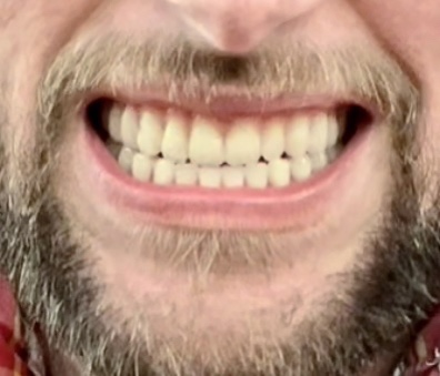 Affordable Dentures & Implants - Longview photo 3
