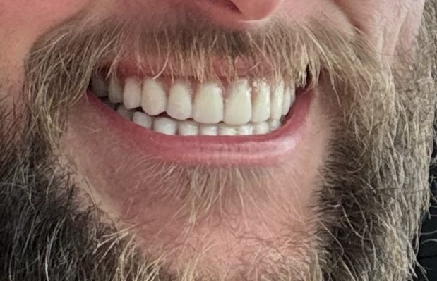 Affordable Dentures & Implants - Longview photo 6