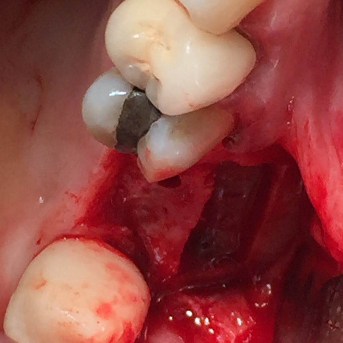 Los Angeles Endodontics and Implant photo 2