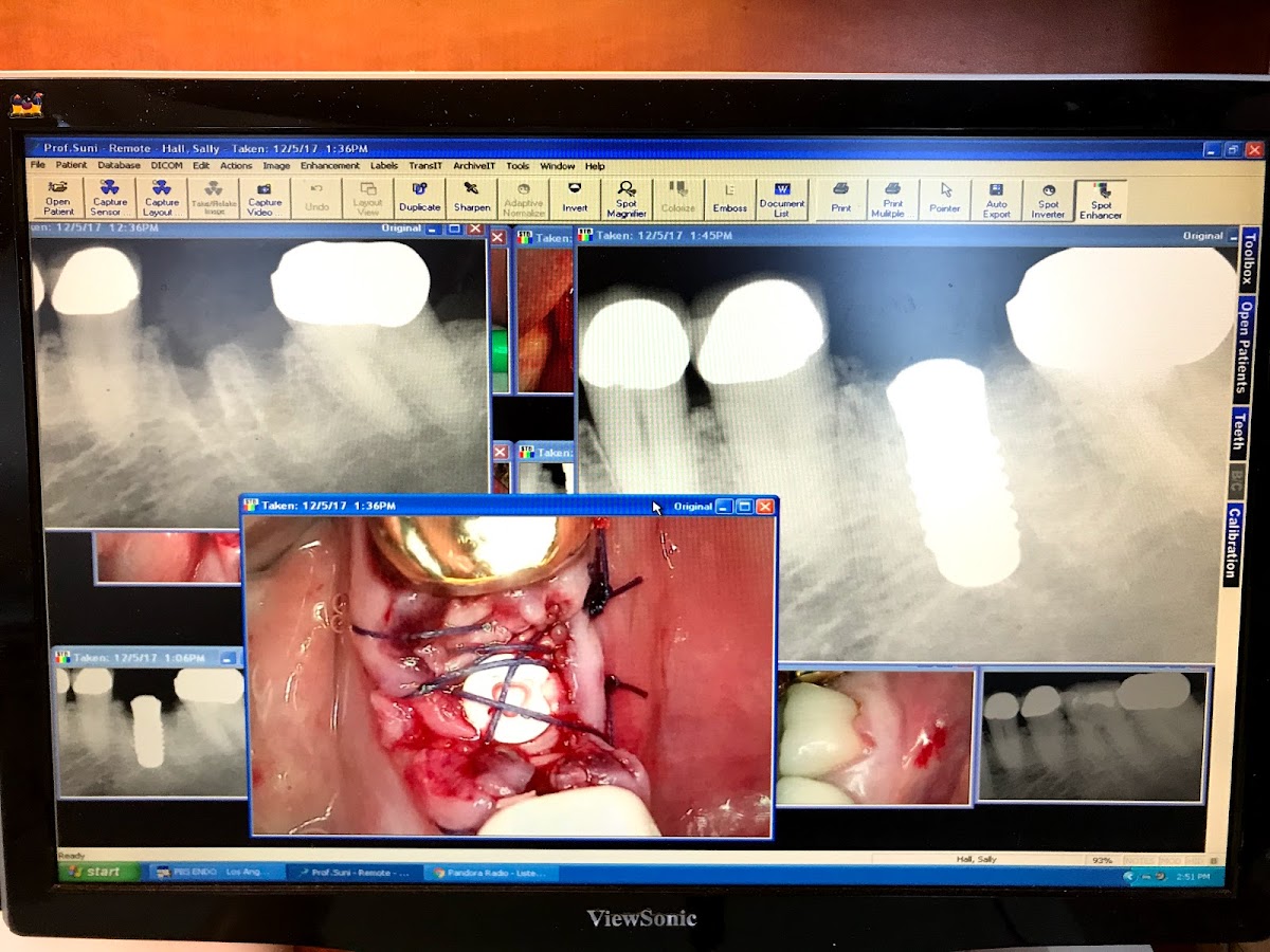 Los Angeles Endodontics and Implant photo 3