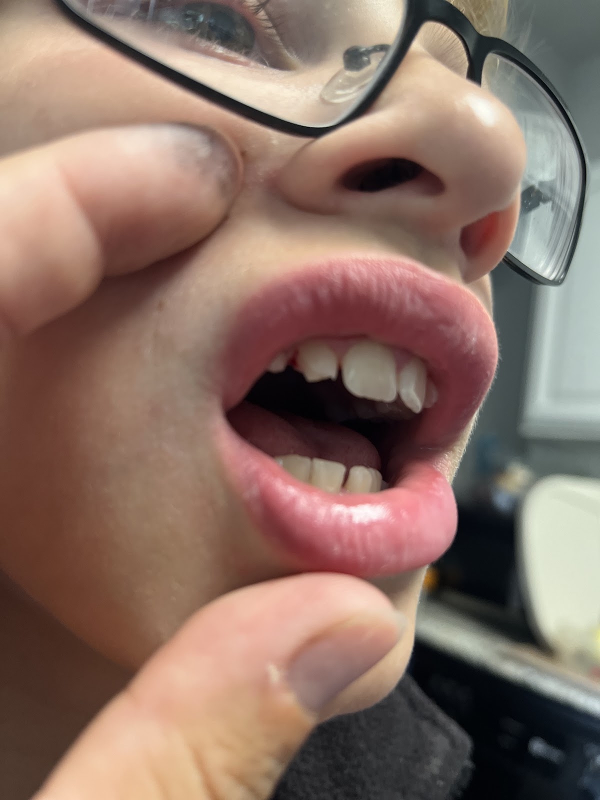 Highwood Dental Studio photo 4