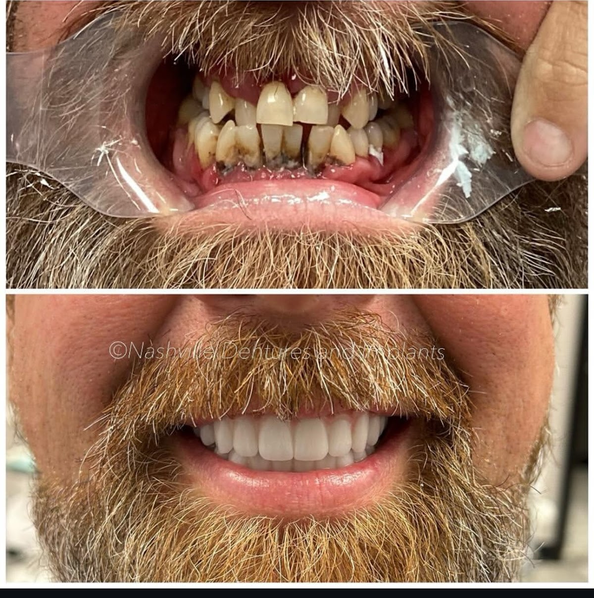 Georgia Implants and Dentures photo 2