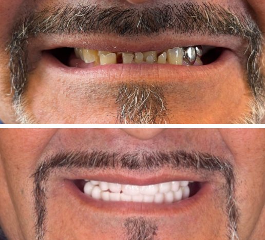 Georgia Implants and Dentures photo 4