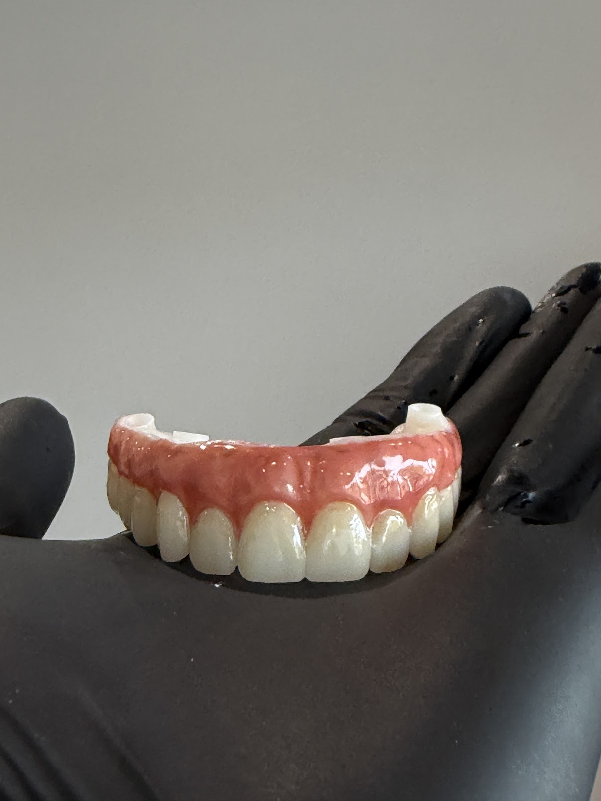 Digital Dental Implants photo 1