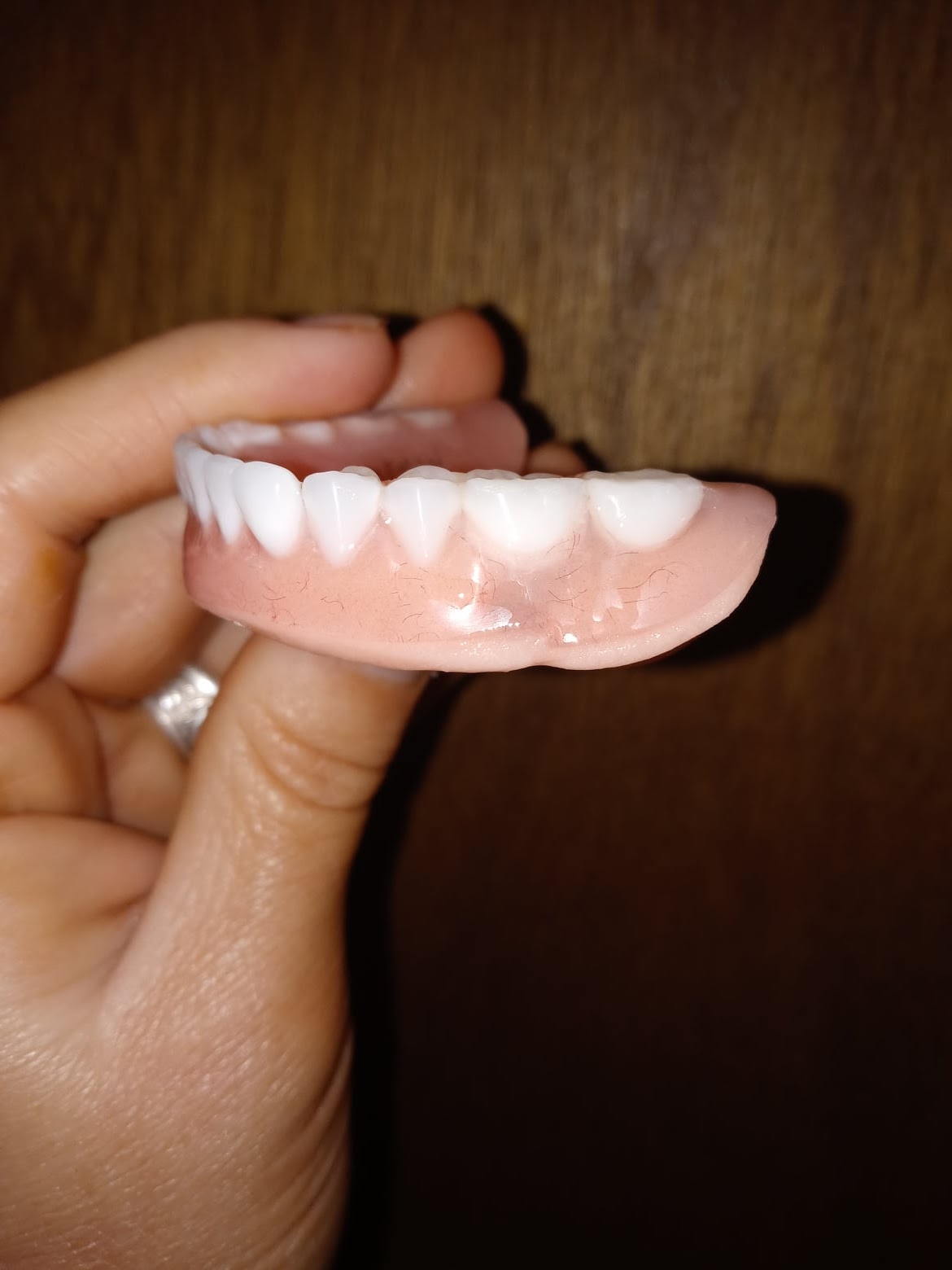 Aspen Dental - Poplar Bluff photo 3