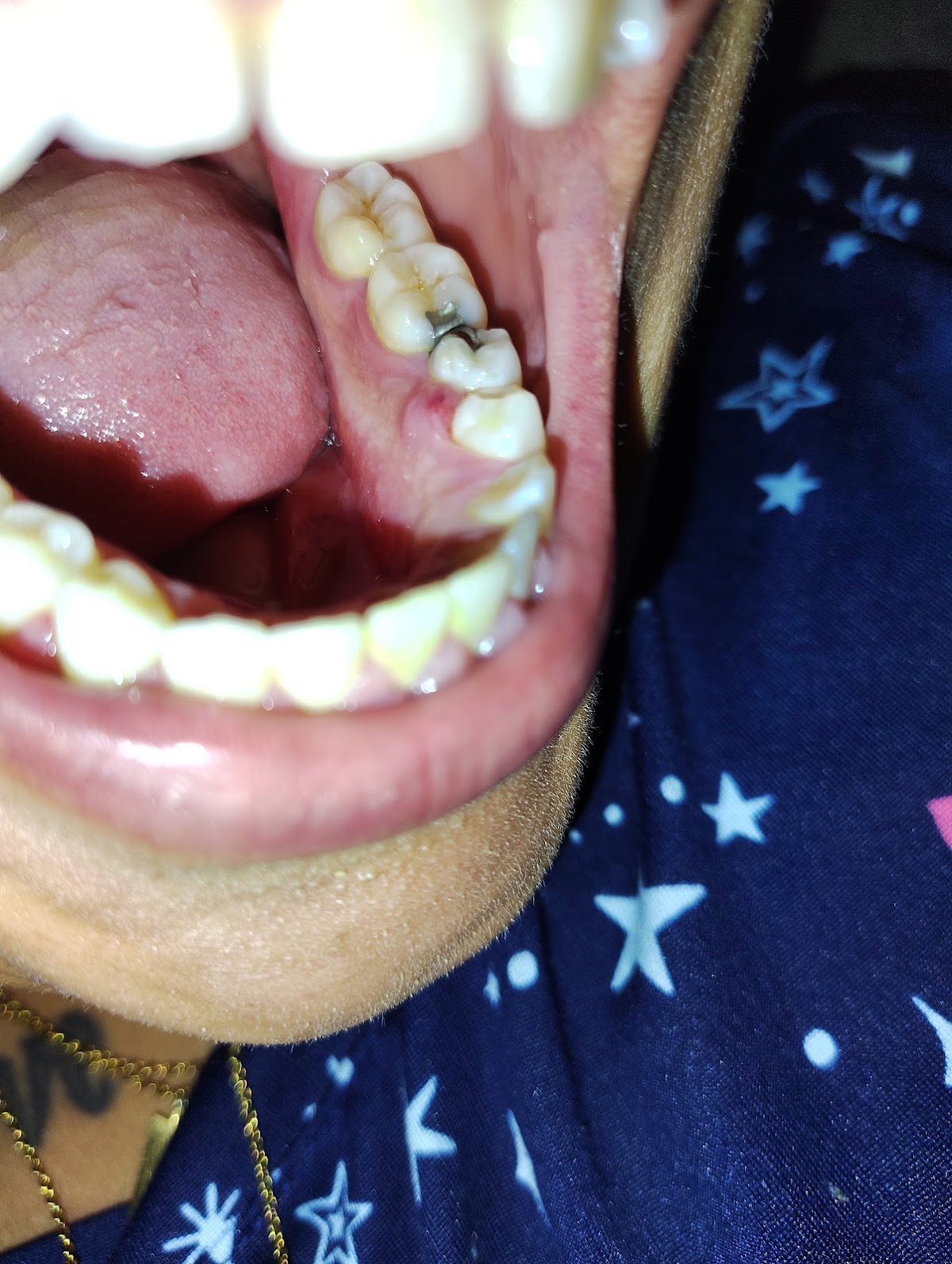 Aspen Dental - Poplar Bluff photo 5