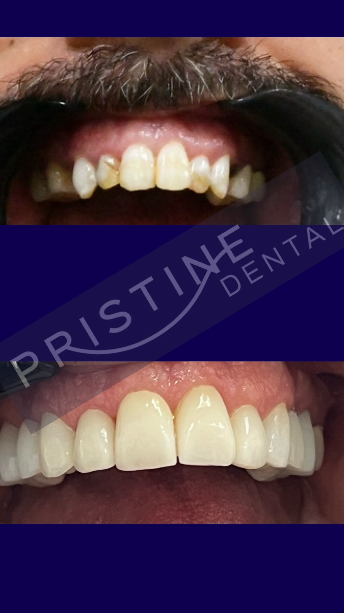 Pristine Dental photo 5