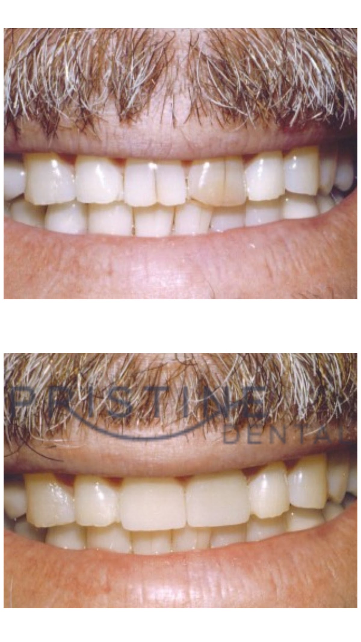 Pristine Dental photo 6