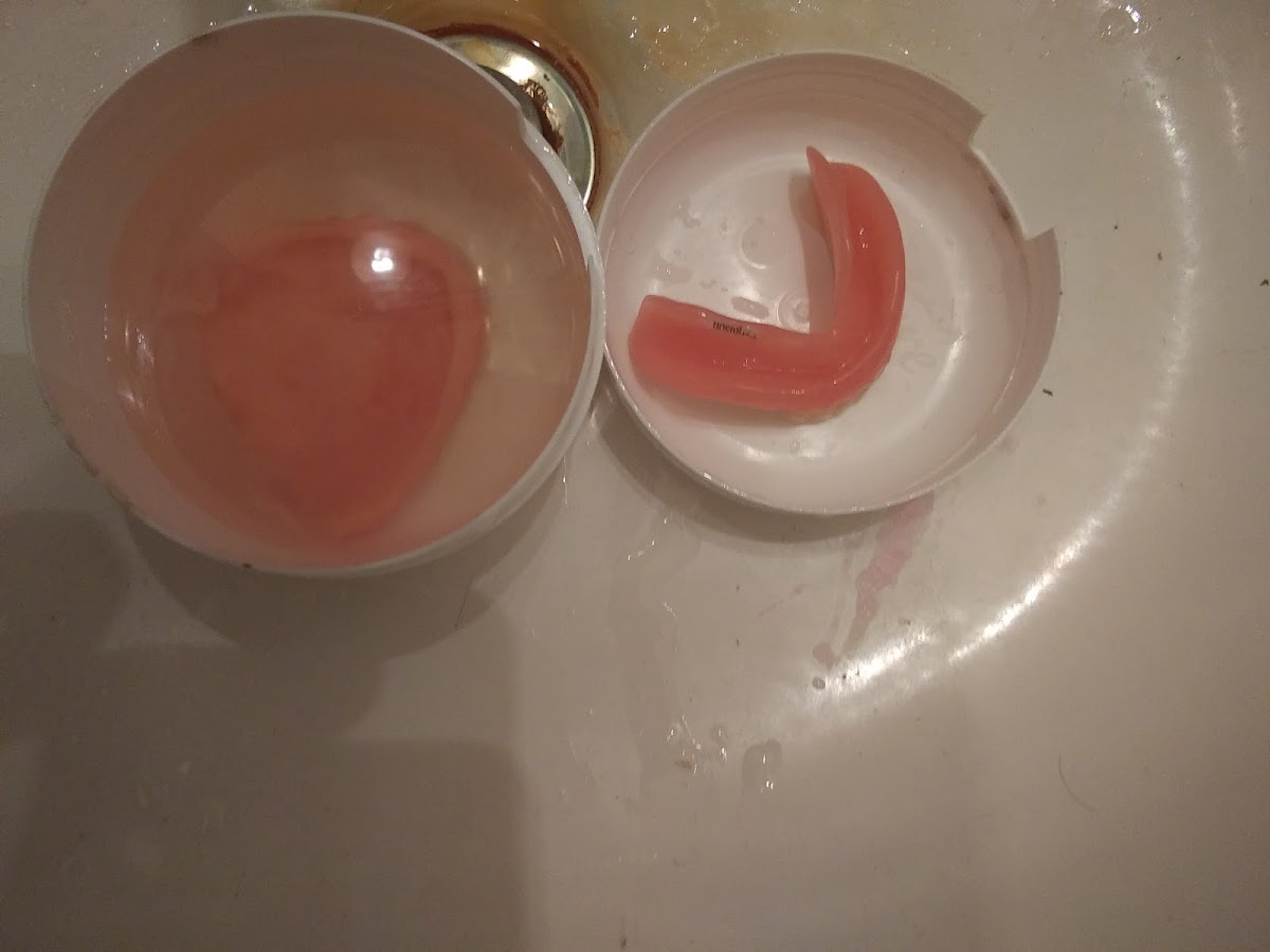Affordable Dentures & Implants - South Bend photo 2