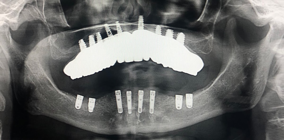 Pristine Oral & Maxillofacial Surgery-dr. Garry Shnayder photo 1