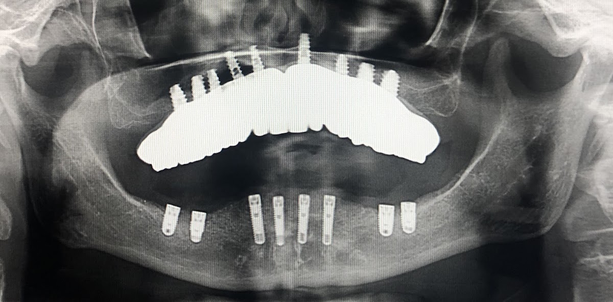 Pristine Oral & Maxillofacial Surgery-dr. Garry Shnayder photo 1