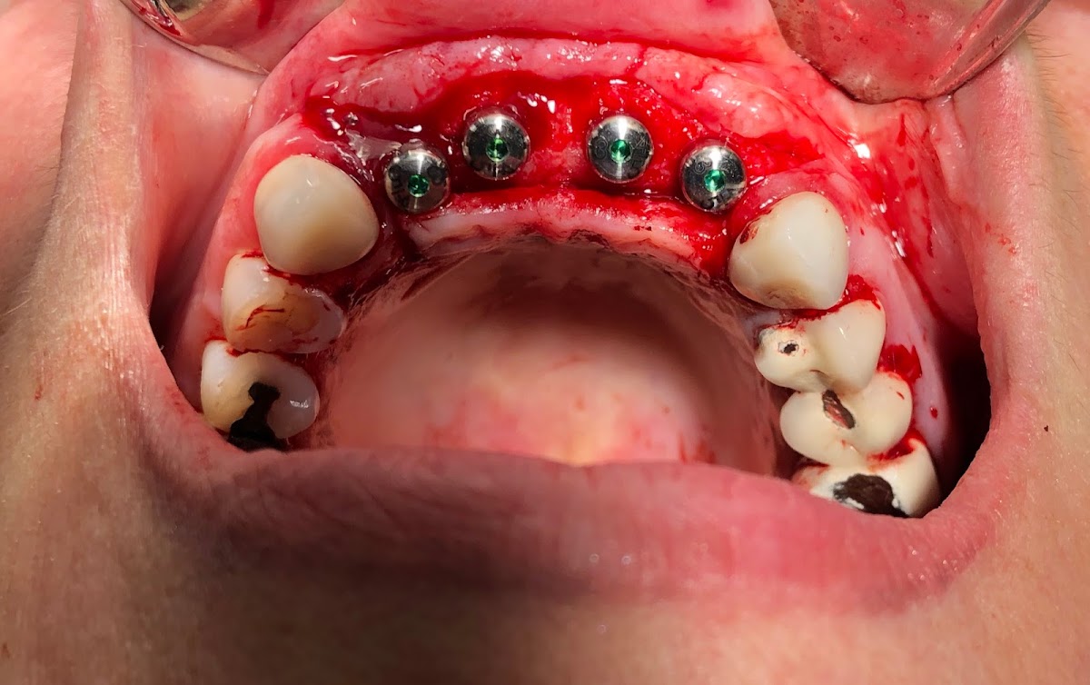 Pristine Oral & Maxillofacial Surgery-dr. Garry Shnayder photo 5