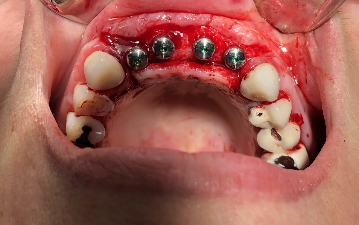 Pristine Oral & Maxillofacial Surgery-dr. Garry Shnayder photo 5