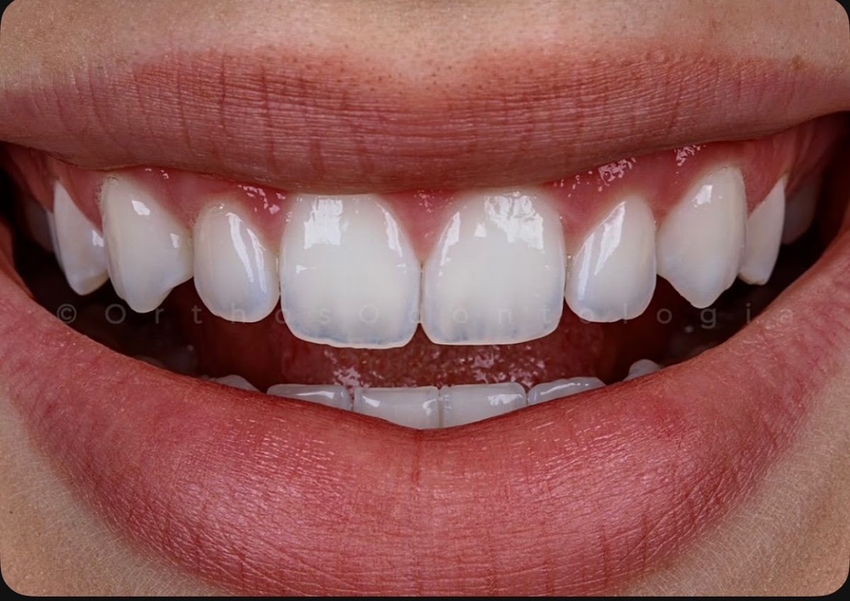 Smile Muse Spa photo 1