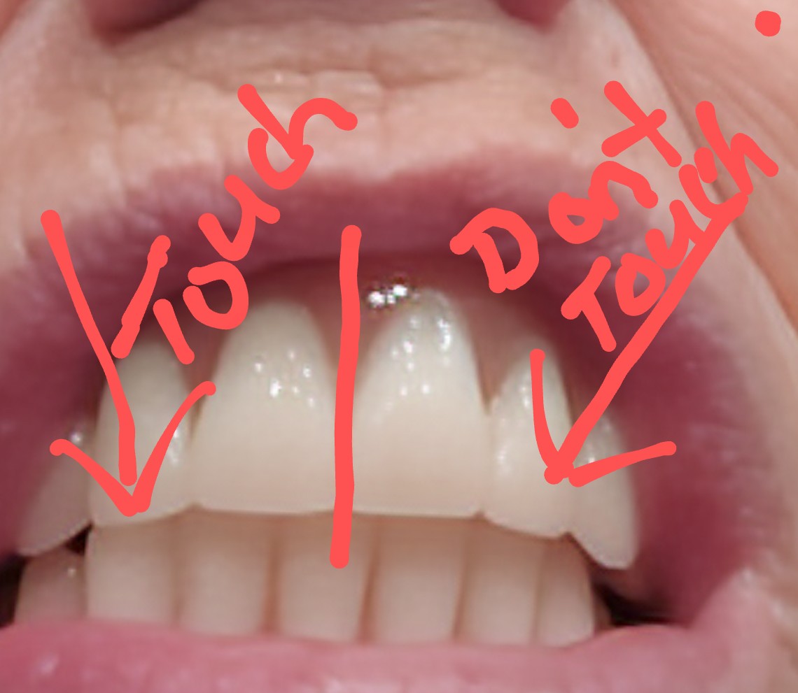 Affordable Dentures & Implants photo 4