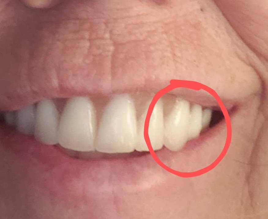 Affordable Dentures & Implants photo 6