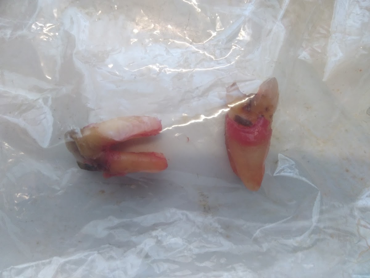 Aspen Dental - Bowling Green photo 3
