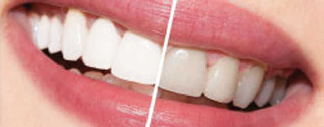 Brantly Dental photo 4