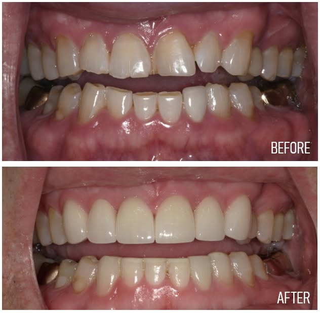 Boulevard Dental photo 1
