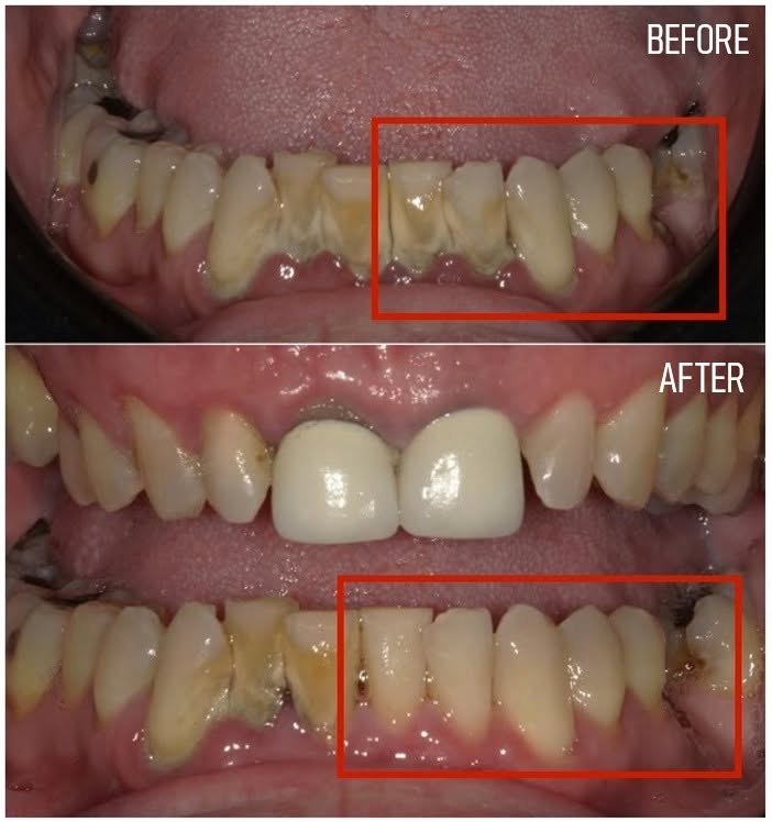 Boulevard Dental photo 2