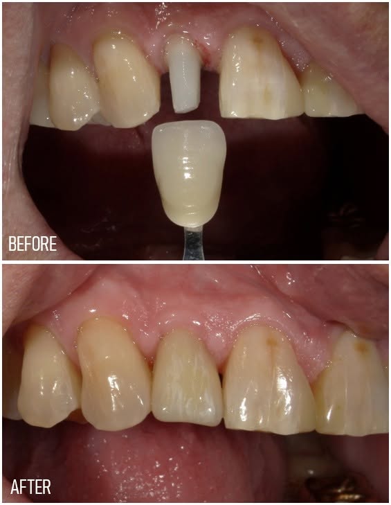 Boulevard Dental photo 3