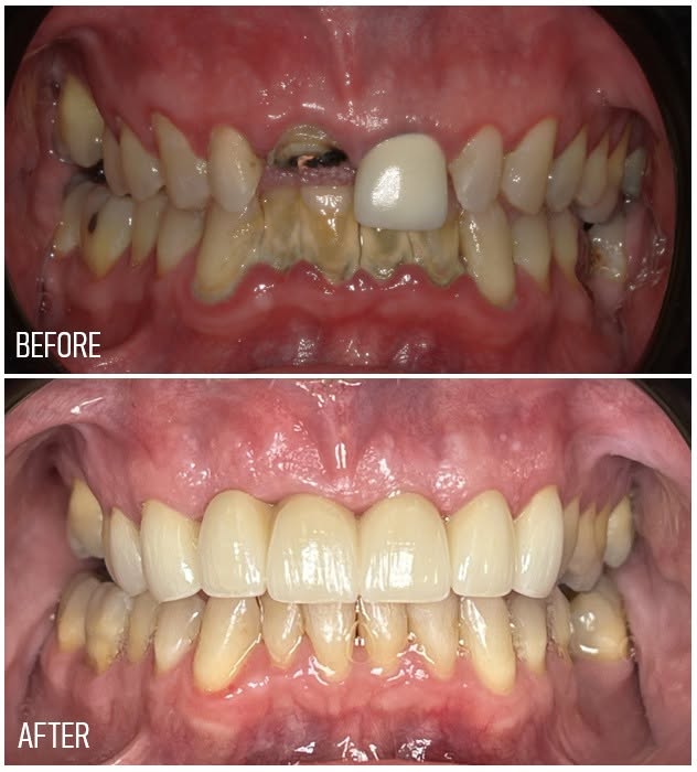 Boulevard Dental photo 4