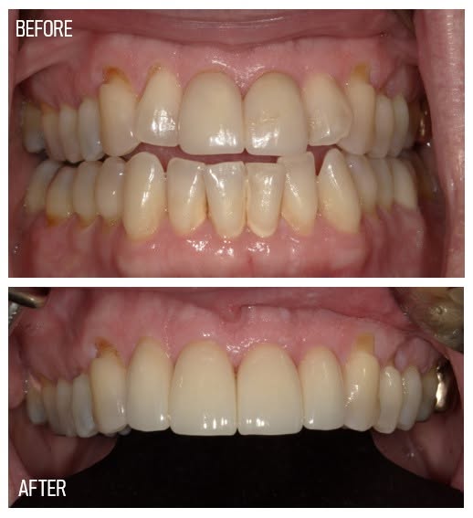 Boulevard Dental photo 5