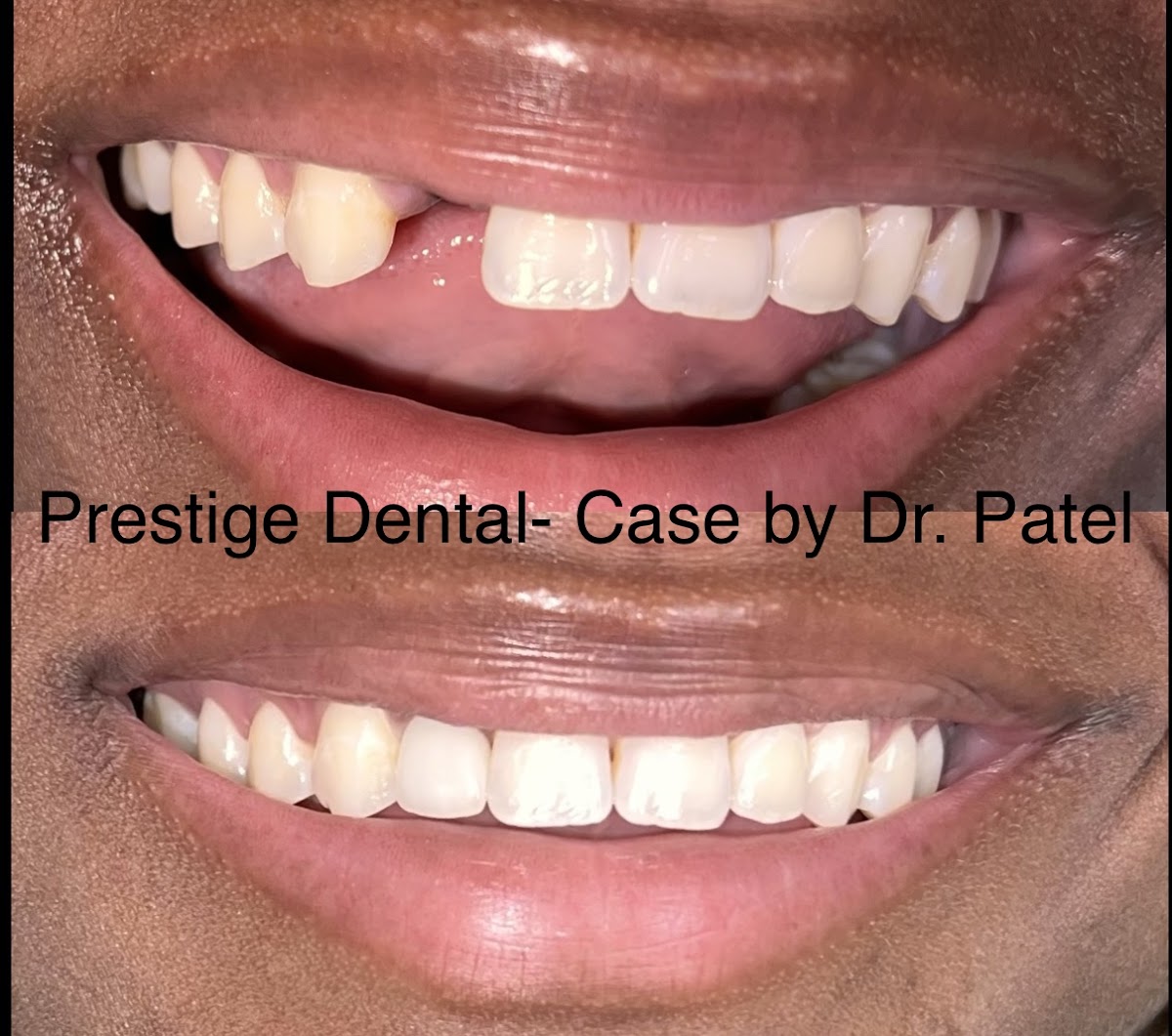 Prestige Dental Dallas & Implant Center photo 4