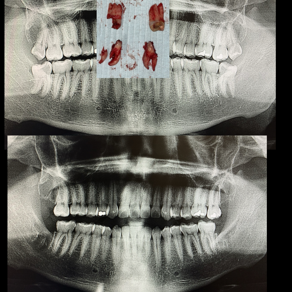 Prestige Dental Dallas & Implant Center photo 6