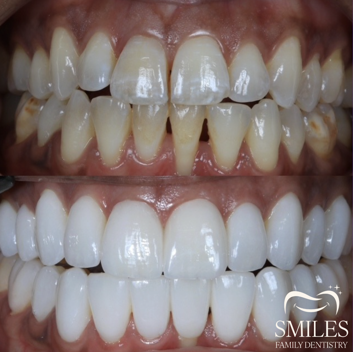 Smile Family Dentistry photo 2