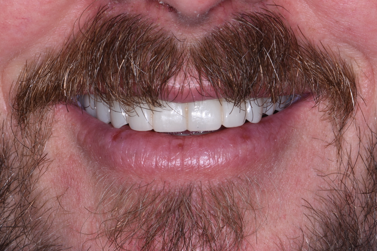 Bird Dental Studio photo 2