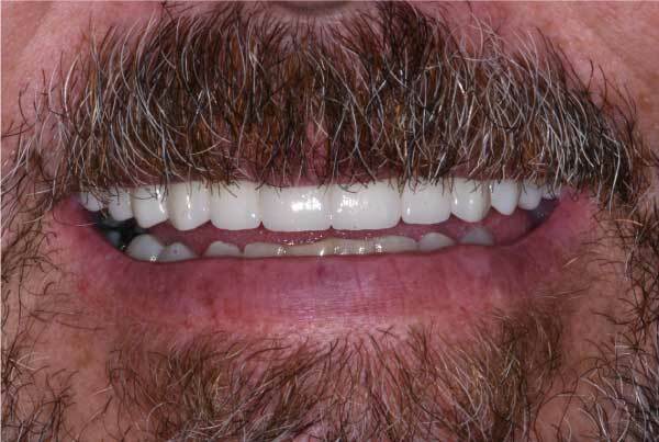 Bird Dental Studio photo 5