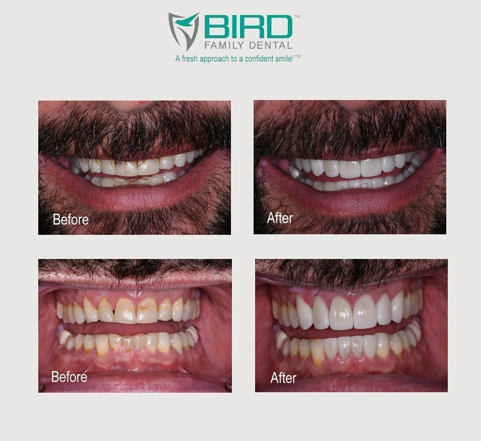 Bird Dental Studio photo 6