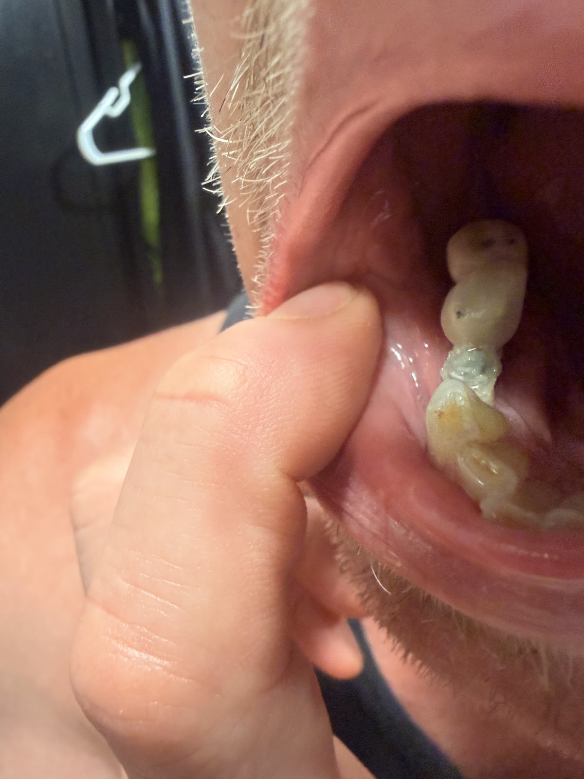 Texas Dental Implants photo 1