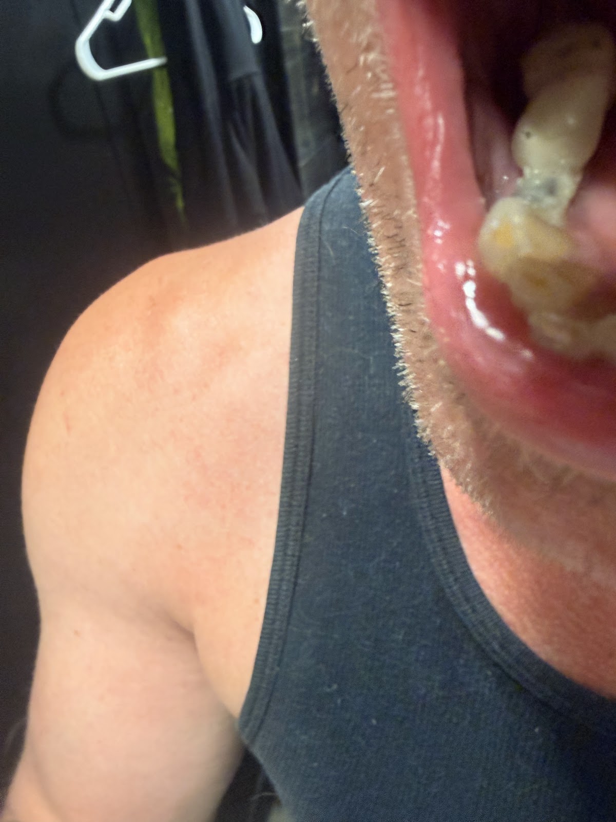 Texas Dental Implants photo 2
