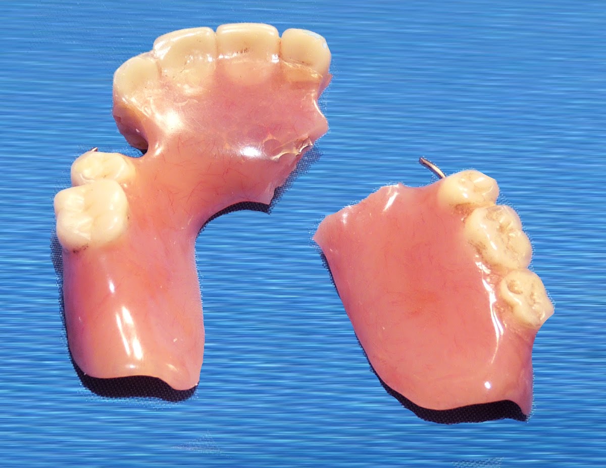 Denture Repair Lab photo 5