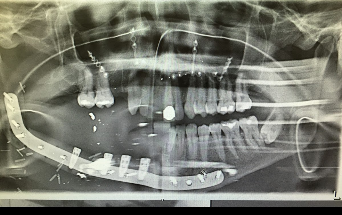 Piney Woods Oral And Maxillofacial Surgery Dr. Brett Shirley photo 2