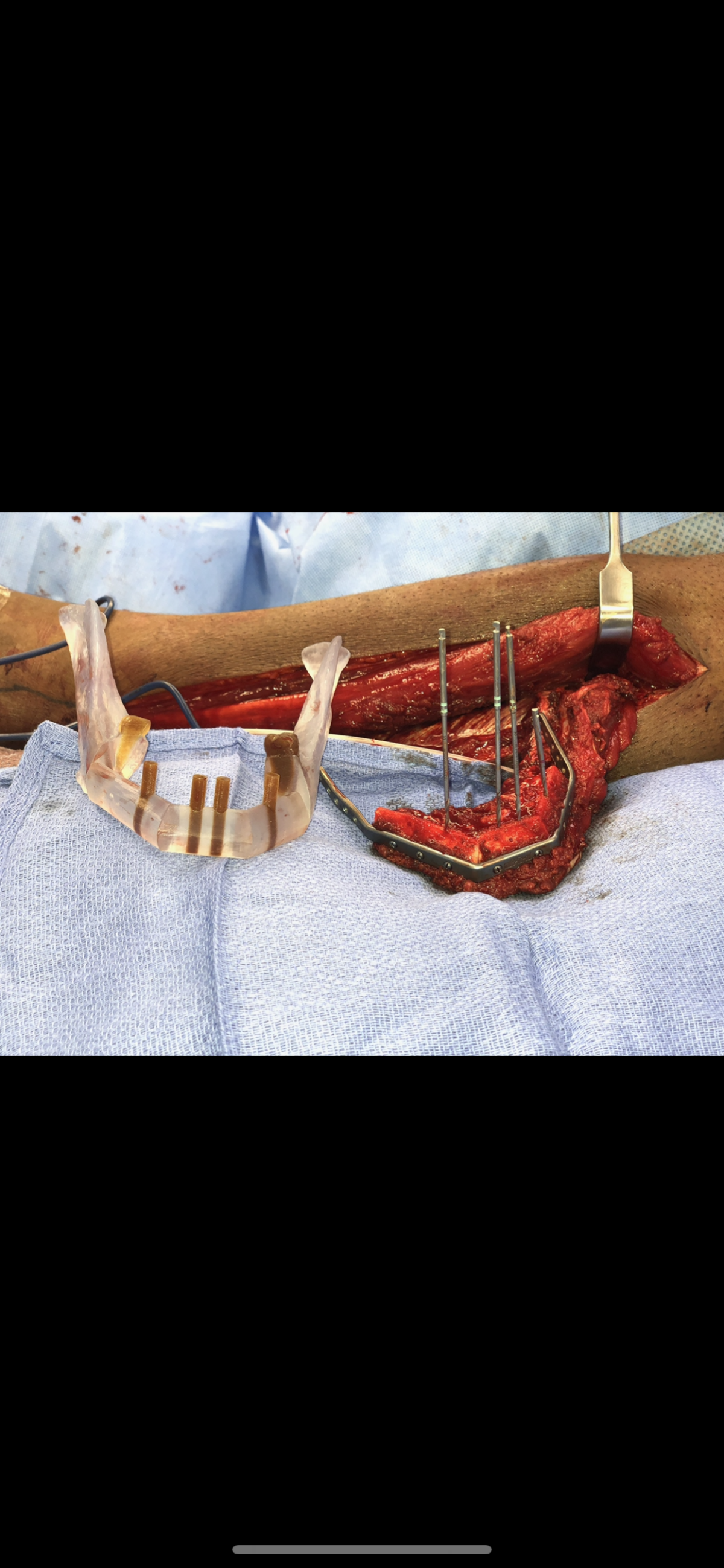 Piney Woods Oral And Maxillofacial Surgery Dr. Brett Shirley photo 6
