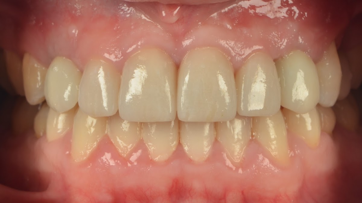 Aesthetic Dentistry of Fairfield photo 4