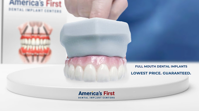 America's First Dental Implant Centers photo 3
