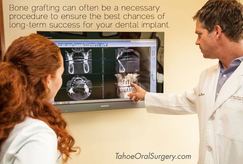 Tahoe Oral Surgery And Implant Center photo 5
