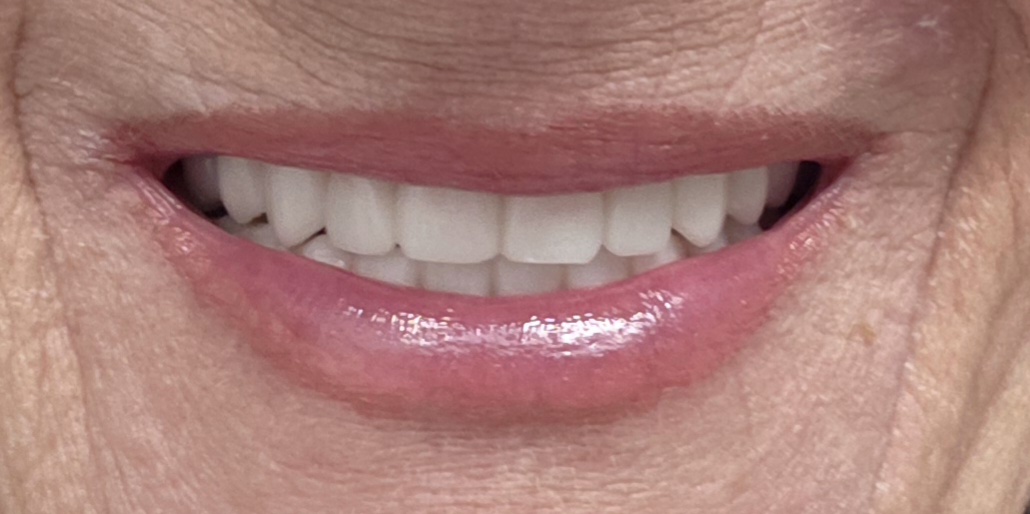 Michigan Dental Implant Studio photo 1