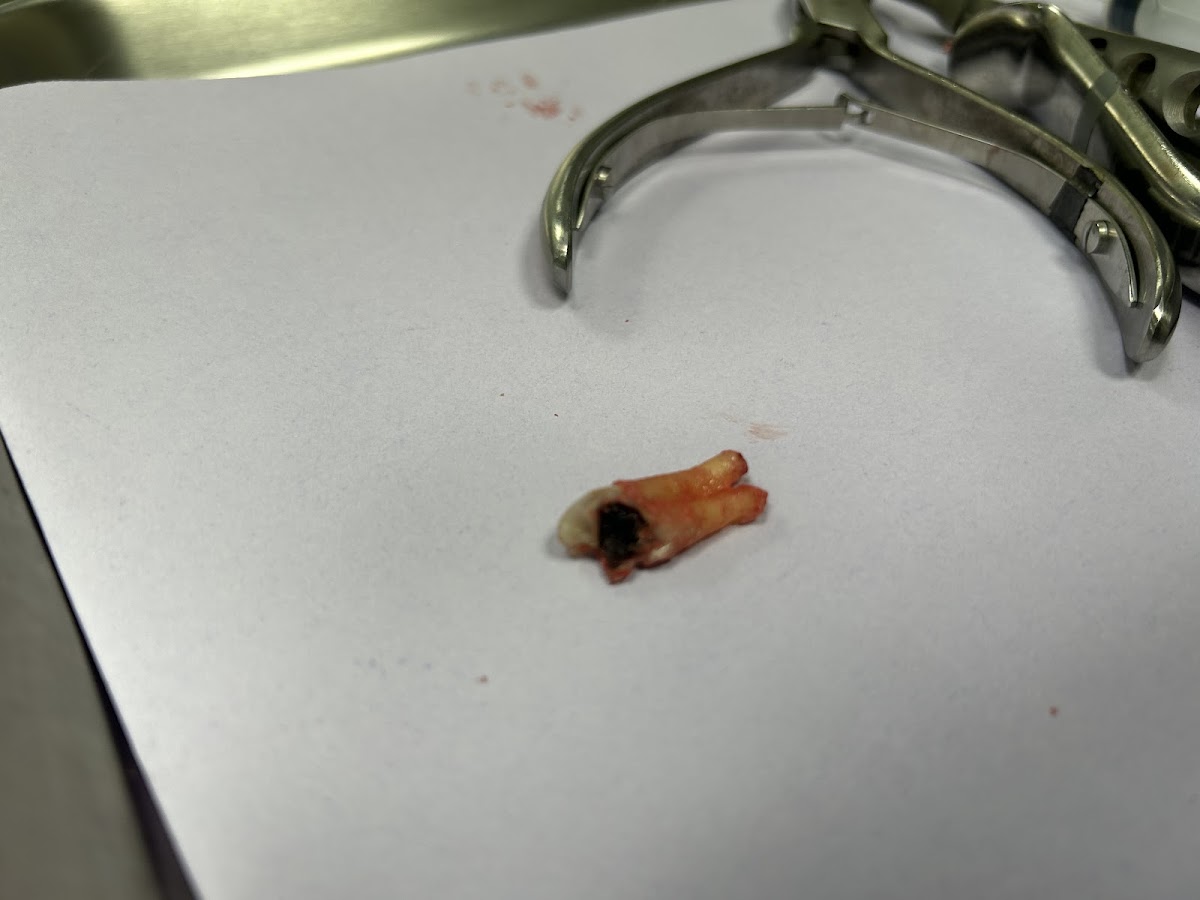 Aspen Dental - Allen Park photo 4