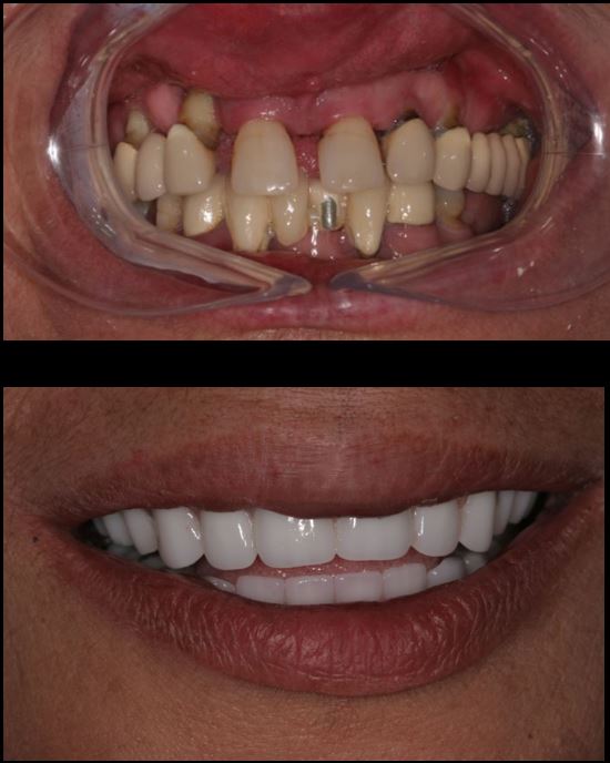 Fixed Dental photo 5