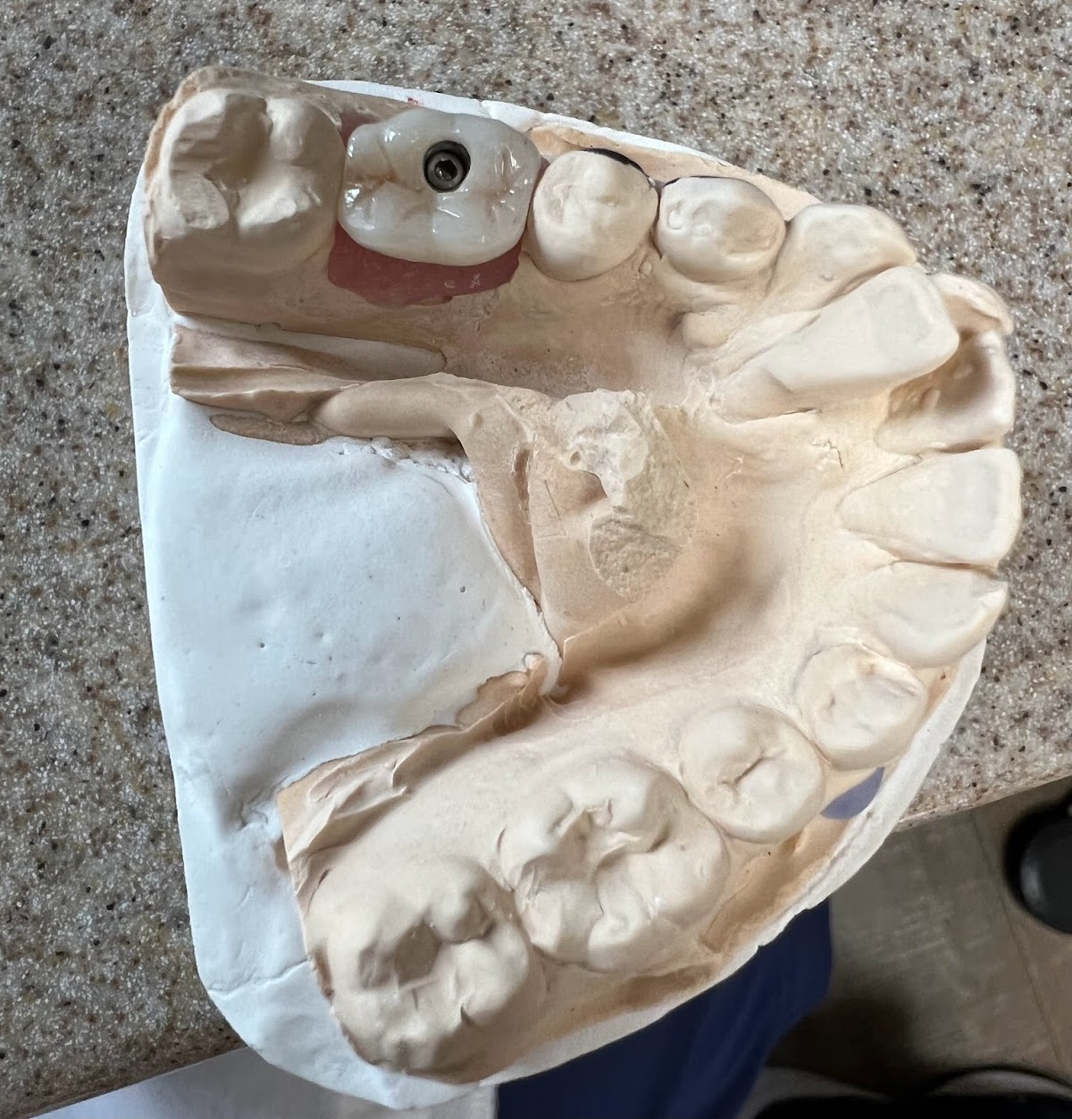 Silver Firs Family & Implant Dentistry photo 5