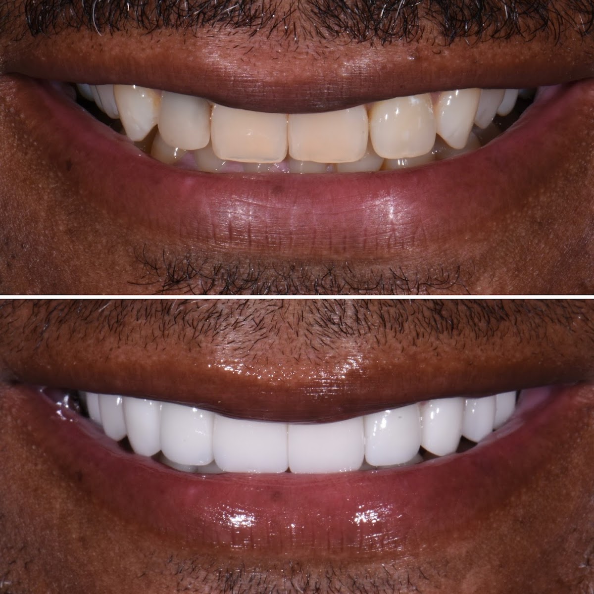 Austin Cosmetic Dentistry by Tejas Patel, DDS photo 2
