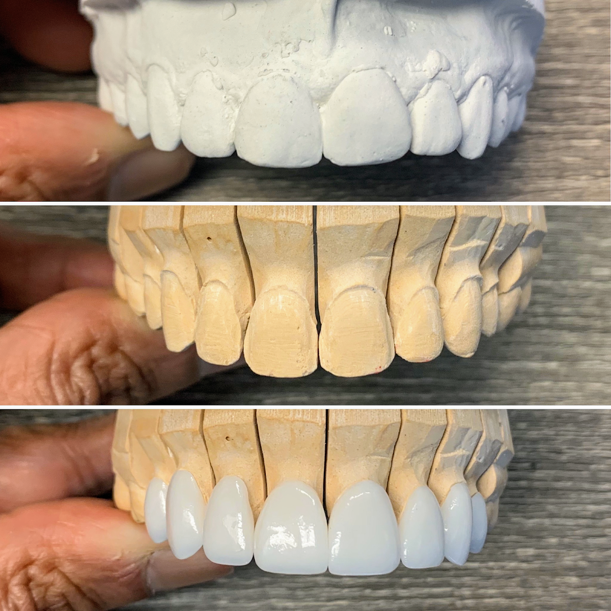 Austin Cosmetic Dentistry by Tejas Patel, DDS photo 3