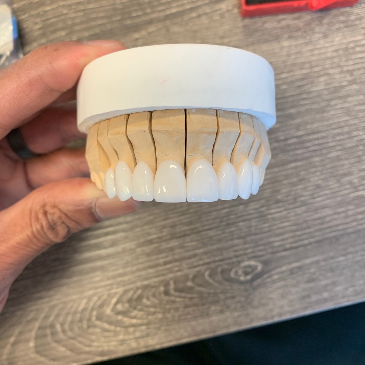 Austin Cosmetic Dentistry by Tejas Patel, DDS photo 5
