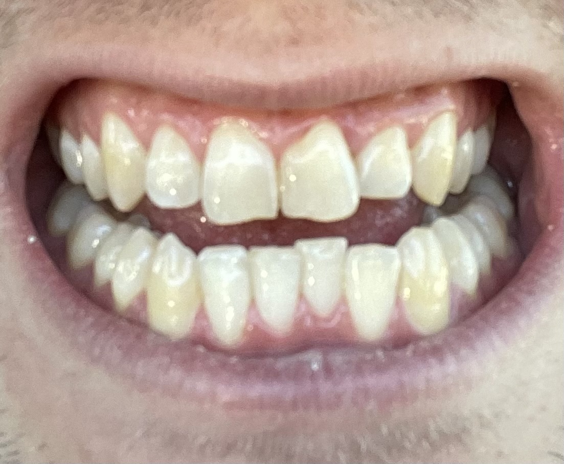Hemphill Dentistry photo 6